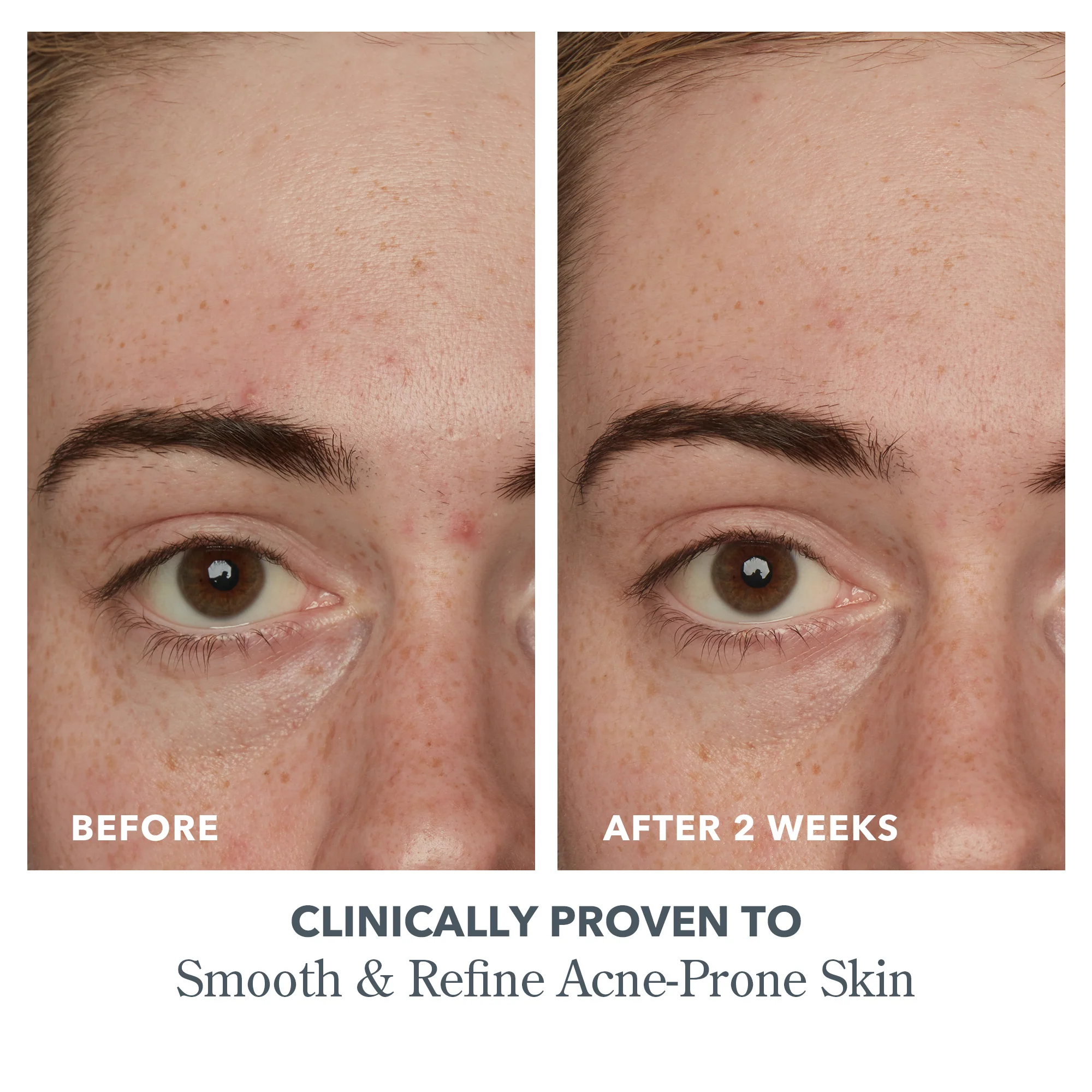 Potato Peel Rapid Resurfacing Milk Facial - Image 7