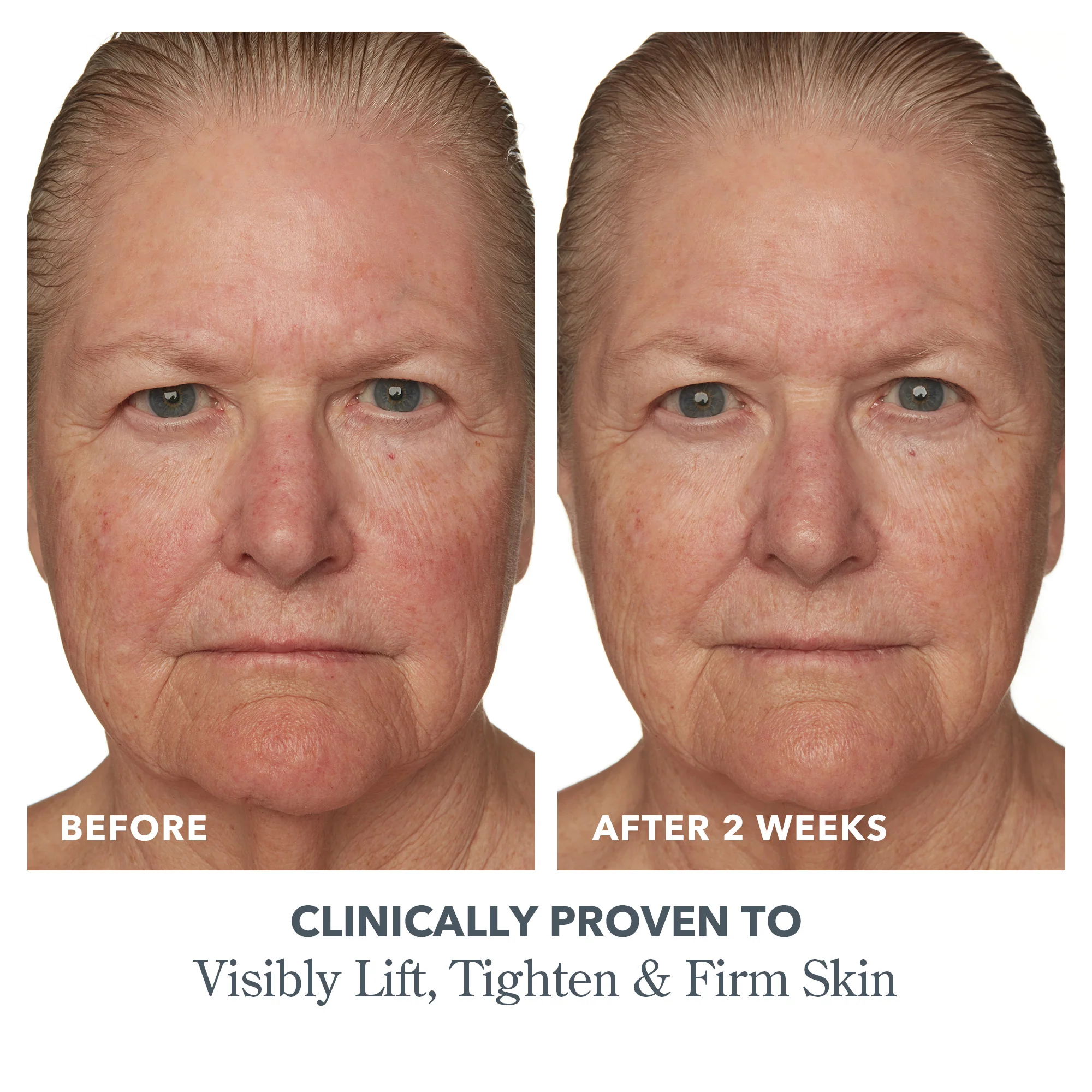 Potato Peel Rapid Resurfacing Milk Facial - Image 8